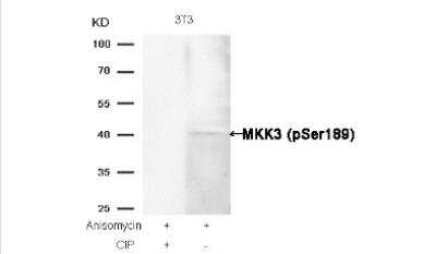 Western Blot: MKK3/MEK3 [p Ser189] Antibody [NB100-82048] - Analysis of extracts from 3T3 cells, treated with Anisomycin or calf intestinal phosphatase (CIP) NB100-82048